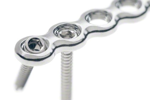 PLS Polyaxial Locking System