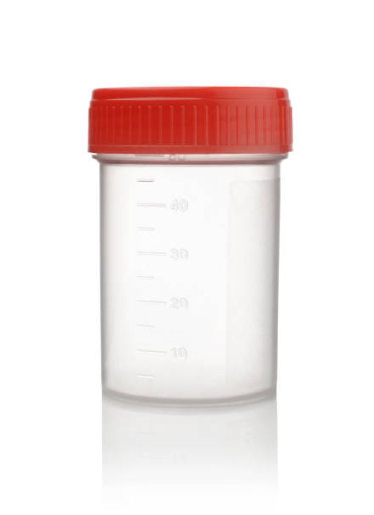 Specimen Container Sterile 120ml