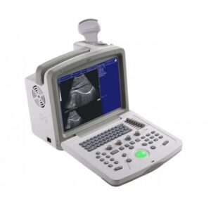 Ultrasound Scanner Wed-180