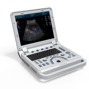 CMS600P2Plus B Ultrasound ��� Portable with Abdomen Convex Probe