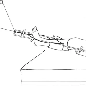 Orthopedic Traction Hospital Bed