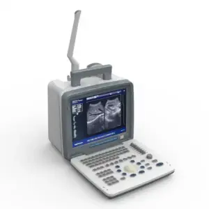 Alternative view of XF300 (LED) B ultrasound diagnose medical instrument